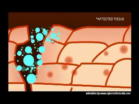 how to isolate bone marrow stem cells