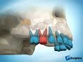 Early Primary First Molar Loss