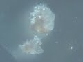 Morgellons Nano Scab Dance Morgellons Nano Scab Dance