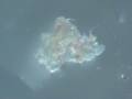 Morgellons Nano Scab Dance