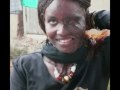 Acid Attacks: Disfigured faces cannot disguise Beauty (Warning -- Graphic Images)