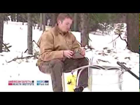 how to treat superficial frostbite