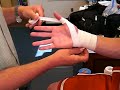 Thumb Spica Thumb Spica