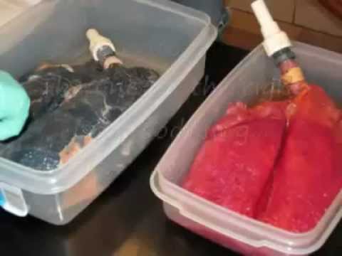 how to rebuild lung capacity