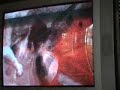 manhunt 2