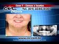 Coroas e Facetas CIR Bras�lia (61) 3346-9001