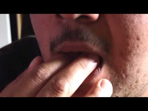 how to properly vomit