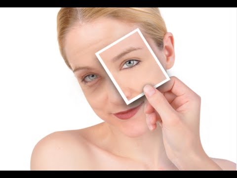 how to relieve puffy eyes after crying