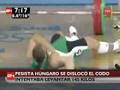 olimpics acident