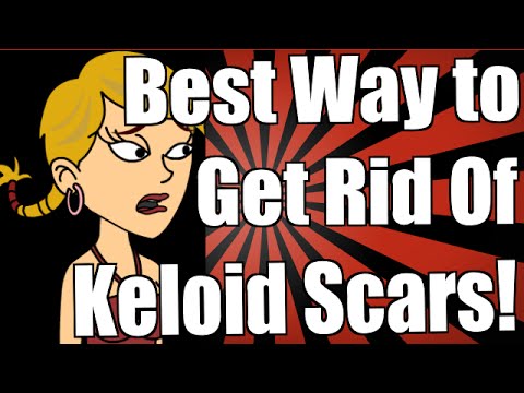 how to get rid keloid scarring