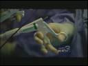 Dr. Stepp performs midwest\