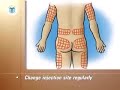 postcare™ diabetes center: injecting insulin