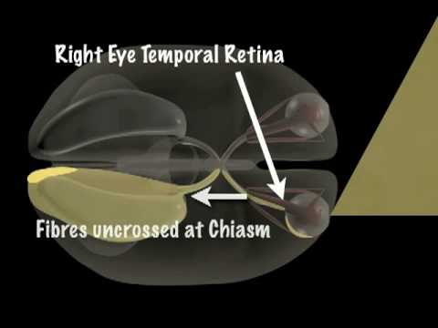 how to perform visual field test