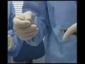 Smartlipo: TV3 interviews Dr. Treacy