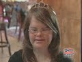 Down syndrome:&nbsp;Down Syndrome Homecoming Queen
