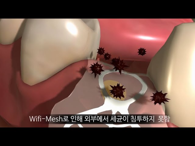 코웰메디 특허 홍보영상 Wifi-Mesh  홍보영상