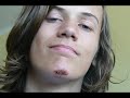 FTC crashes