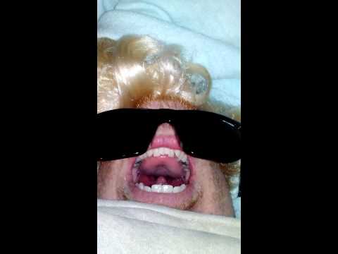 bald fanny
