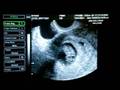 videos de Little Bear says hello