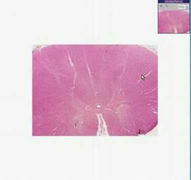 Histopathology Skeletal muscle, ...