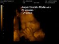 Joaquín Stendelis Montesanto Joaquín Stendelis Montesanto