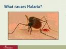 Compassion's Malaria Intervention Webcast