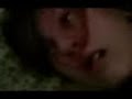 Epileptic attack