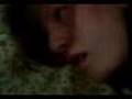Epileptic attack