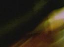 Green Laser