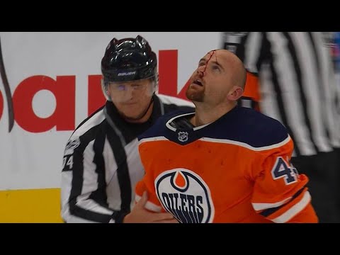 Video: Kassian cut by Glass after throwing hands