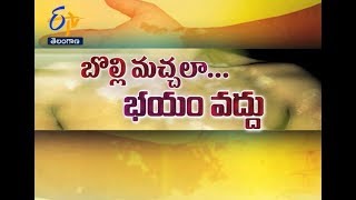 Vitiligo Day | Sukhibhava | 25th June 2017 | Full Episode | ETV Telangana