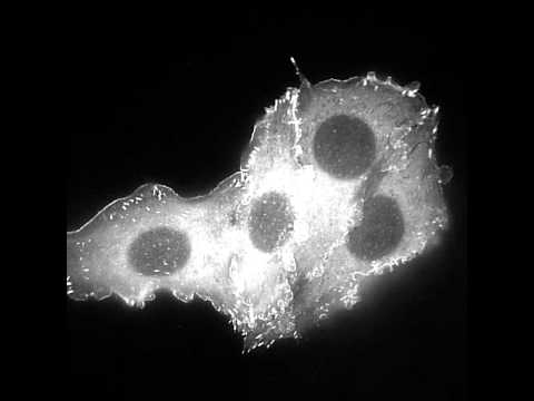 Focal adhesions form during lamellipodial protrusion and are essential for cell spreading