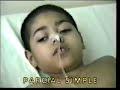 Video de la clinica de epilepsia y sueño
