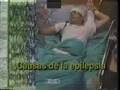 Epilepsia 1
