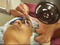 Trinna's Lasik Eye Surgery Trinna's Lasik Eye Surgery