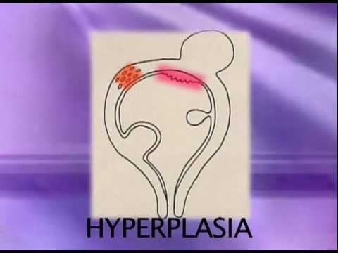 how to bleed artificially on first night