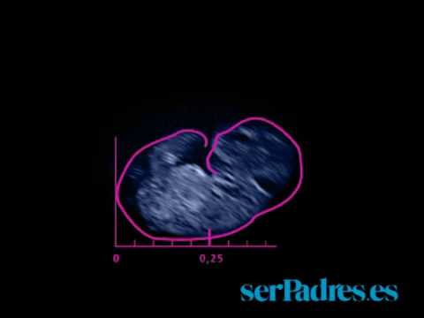 El desarrollo del feto en las semanas 5 - 8 de embarazo