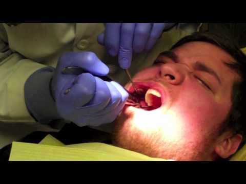 how to cure wisdom tooth pain