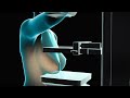 Mammogram