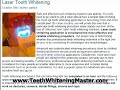 Teeth bleaching - Do Your Friends Believe You Need It? http://ping.fm/2FmIm