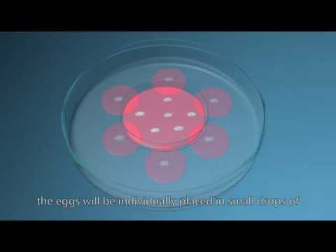 how to decide whether to have ivf