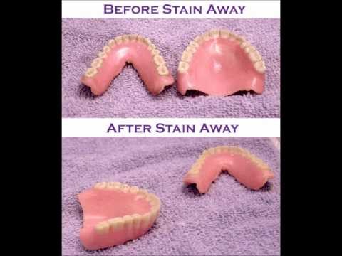how to whiten stained dentures