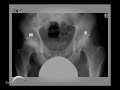What is the BMHR? Lecture Video Part 1 What is the BMHR? Lecture Video Part 1