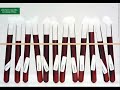 Campañas de publicidad de Benetton-Toscani Campañas de publicidad de Benetton-Toscani