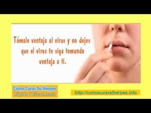 herpes circinado}