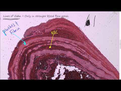 how to treat rbc morphology