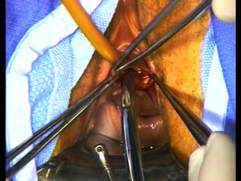 how to repair ureteral injuries
