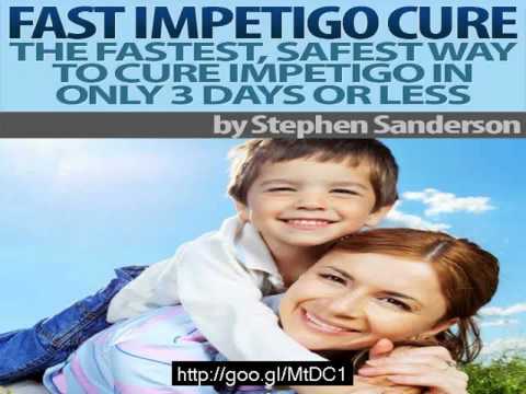 how to cure impetigo