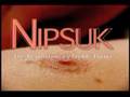 Nipsuk Nipple Pump