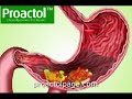 How Proactol Works How Proactol Works